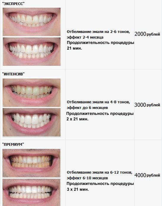 Отбеливание зубов на сколько тонов купить ирригатор в москве цены