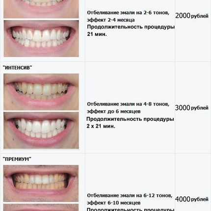 Косметическое отбеливание зубов